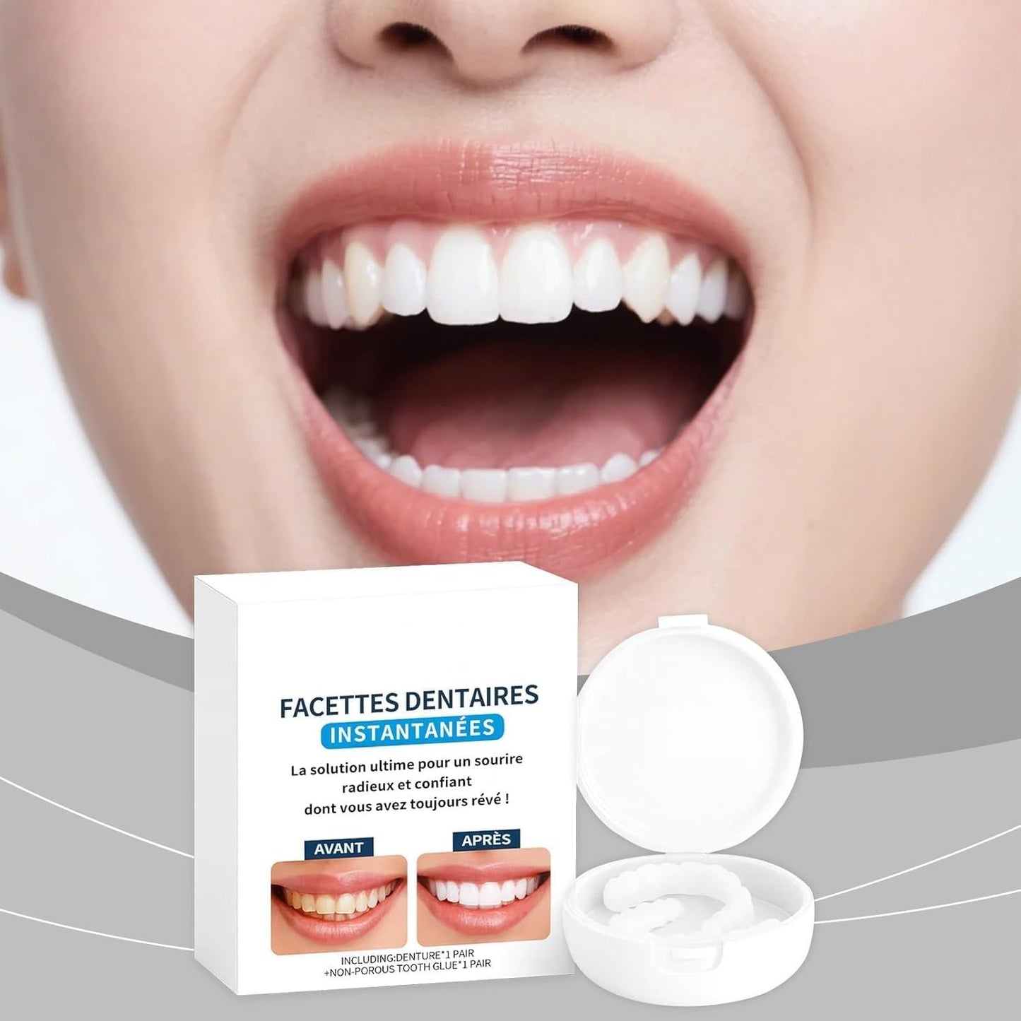 Snap-On Smile Teeth | ابتسامة سناب أون للأسنان